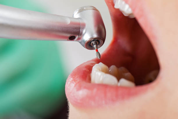 Best Emergency Dental Extractions in Nephi, UT